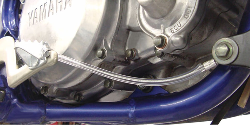 Pedal Anchor Kit Silver